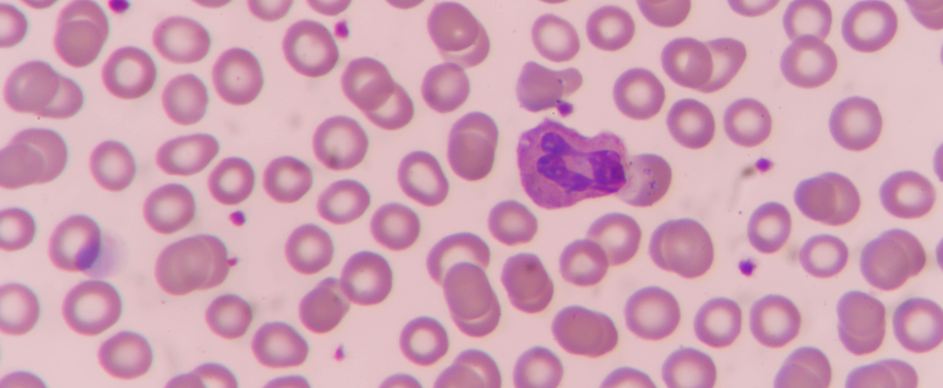 Optimed Sağlık Grubu - Sağlığınız Güvende